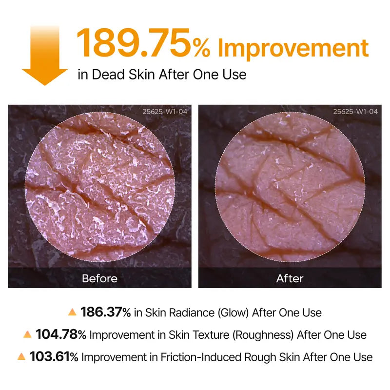 Exfoliating Keratin Kojic Turmeric Spray