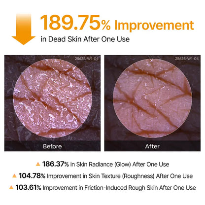Exfoliating Keratin Kojic Turmeric Spray